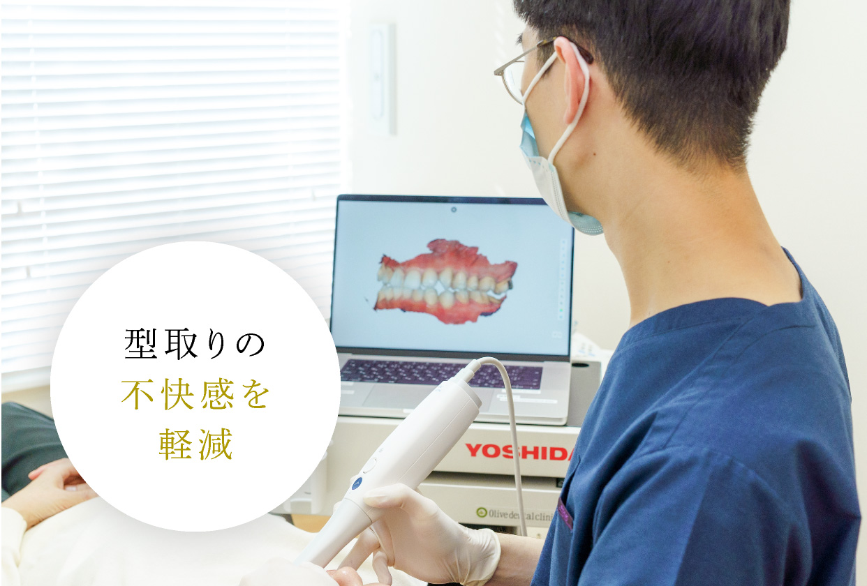 型取りの不快感を軽減